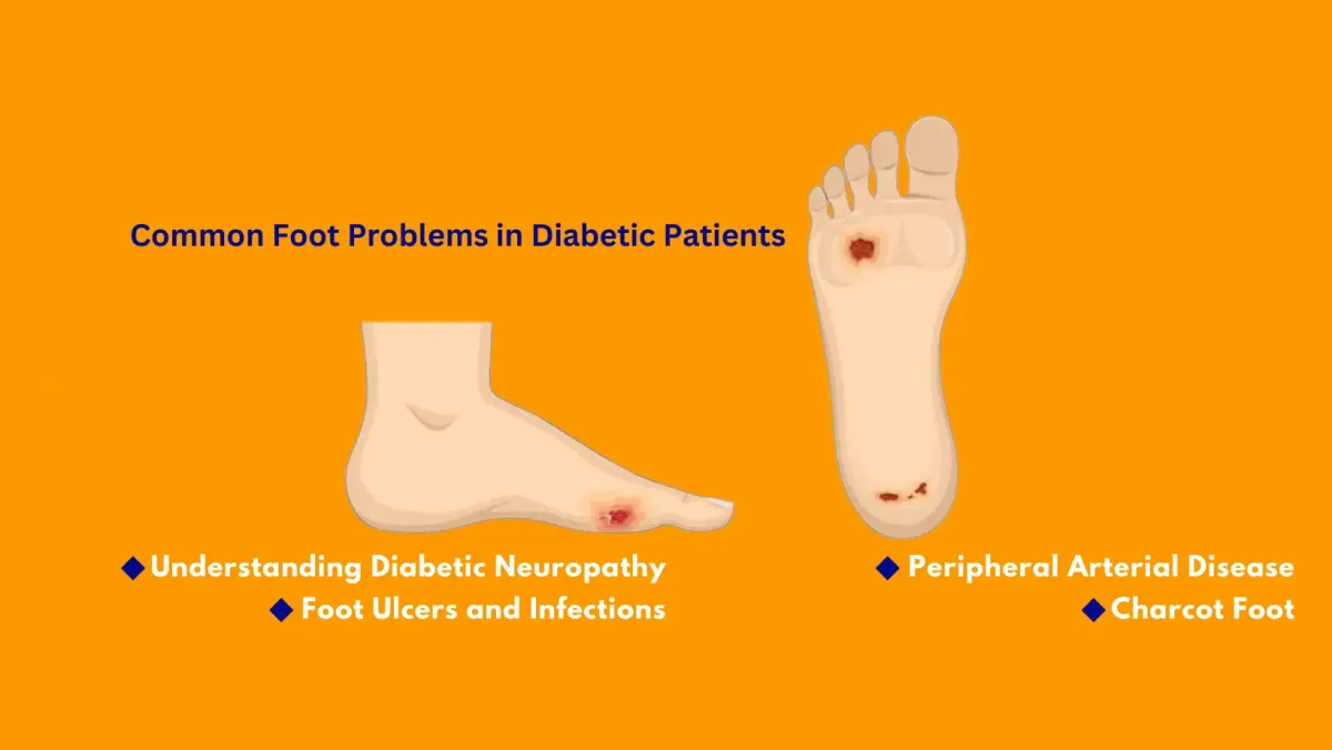 Common Foot Problems in Diabetic Patients: Prevention and Care